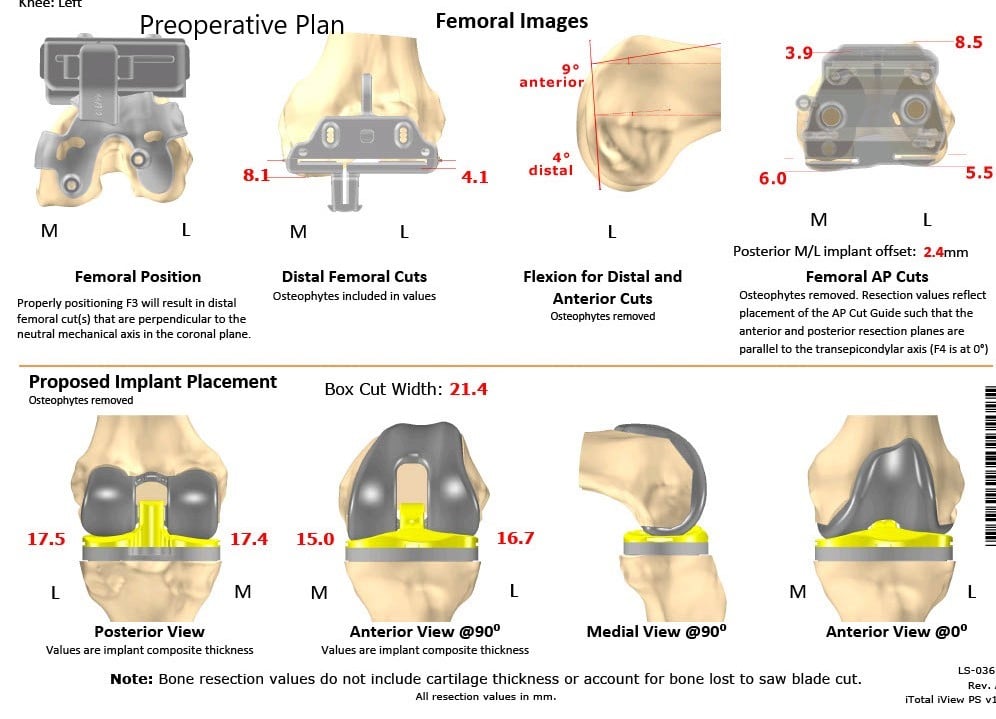 nursing case study total knee replacement