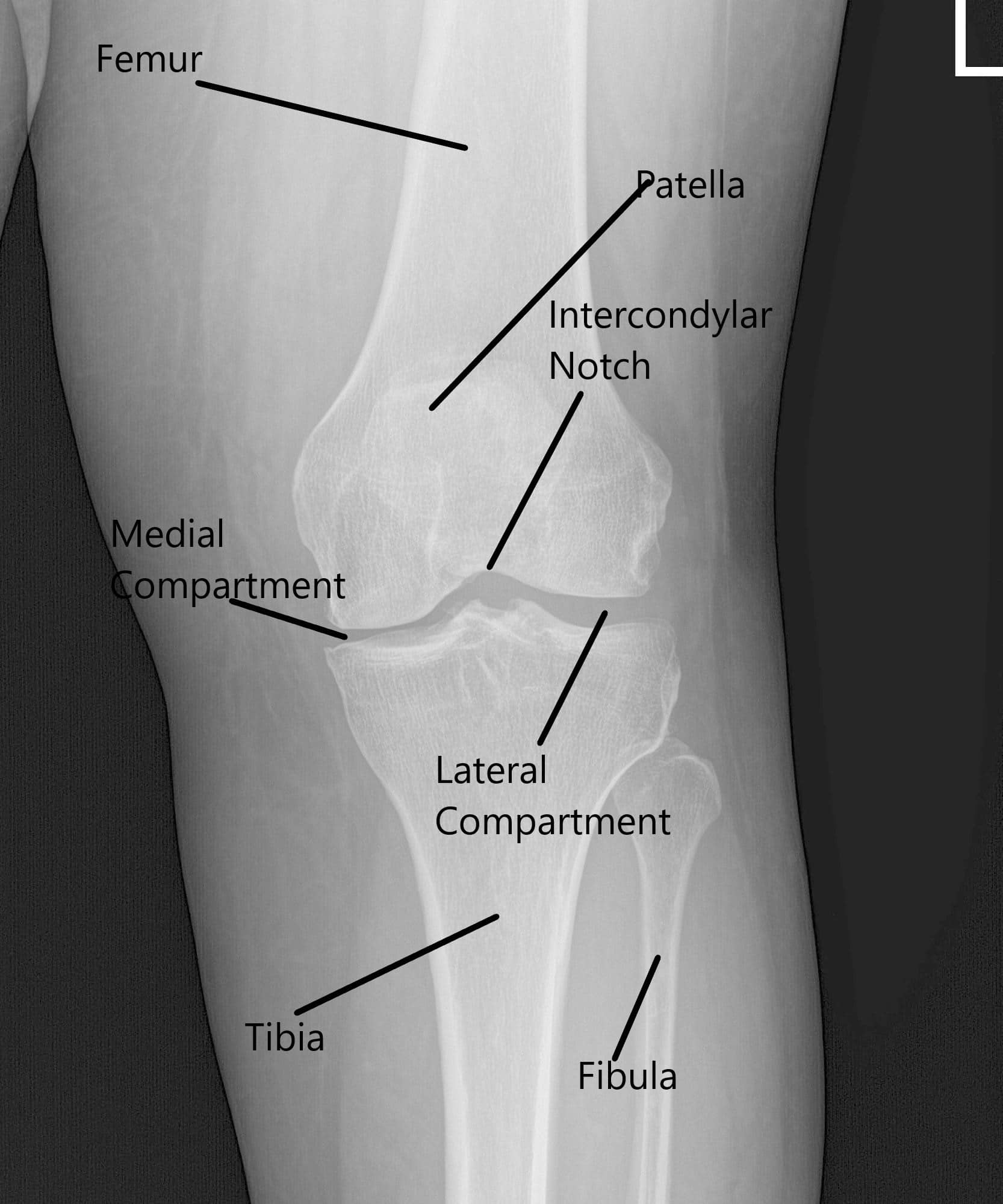 Anatomy Of The Knee Joint With Diagrams And X Ray Owl - vrogue.co