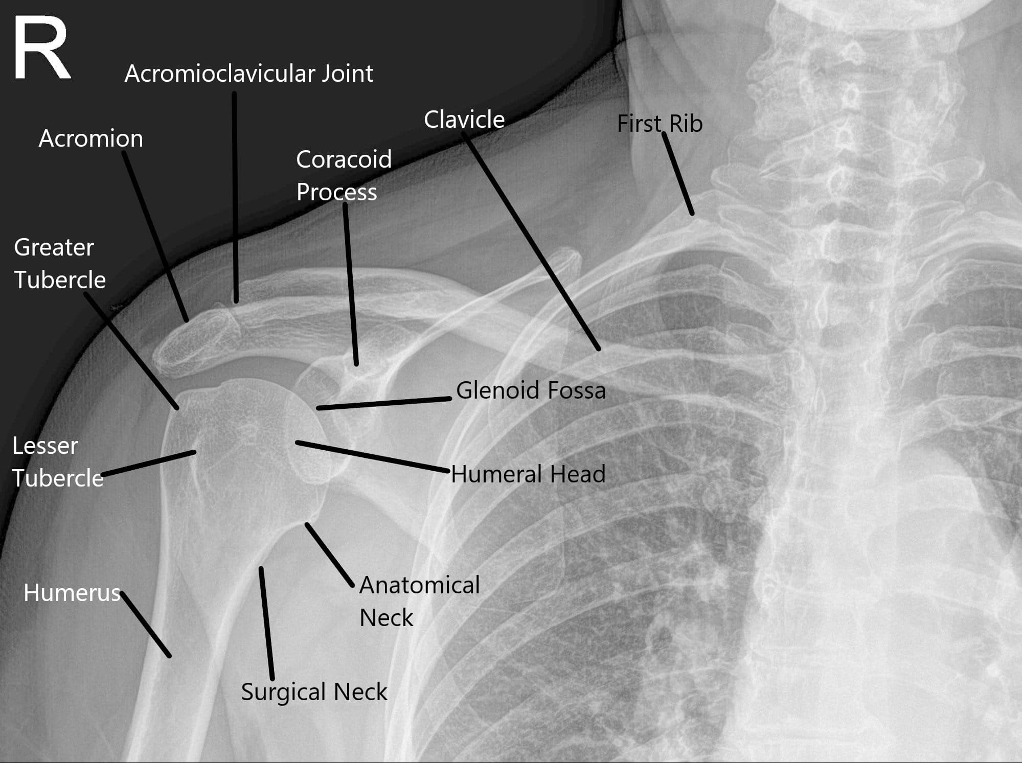 Arthroscopy - Shoulder Joint - Complete Orthopedics | Multiple NY Locations
