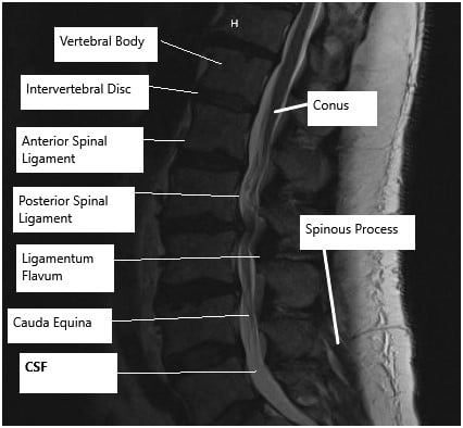 Cirugía de columna lumbar, especialista en columna vertebral en