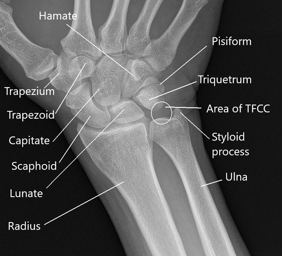 Causes and Management of Wrist Joint Pain - Complete Orthopedics