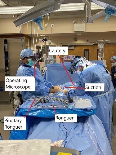 Intraoperative image showing microdiscectomy surgery. Intraoperative image showing microdiscectomy surgery.