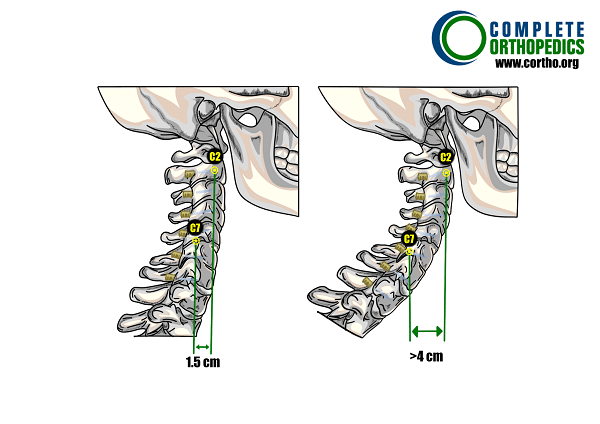 The Cervical Spine: Anatomy, Function, and Common - Spine Center